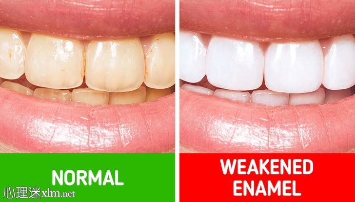 10个你可能永远都不需要看牙医的牙齿护理小贴士