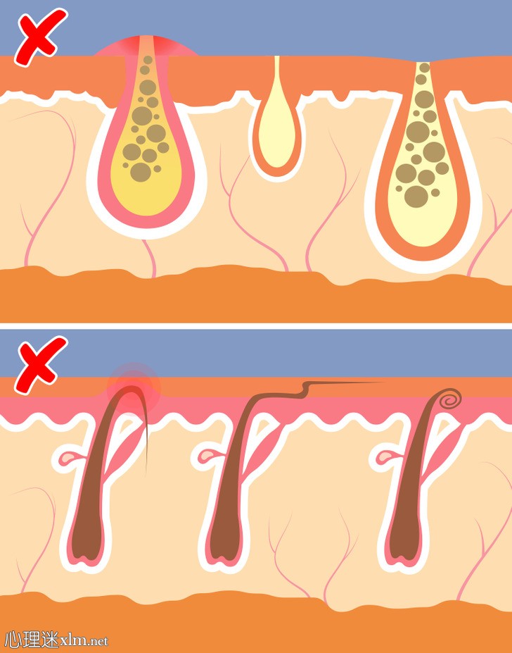 如果你不刮体毛会发生什么