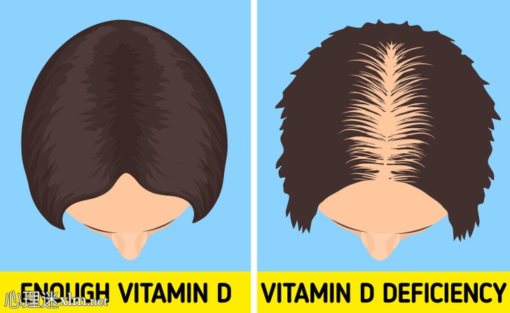 你缺乏维生素D的6个警告信号