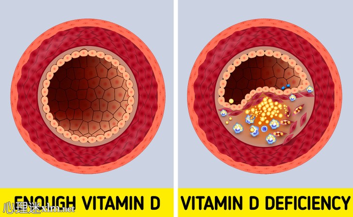 你缺乏维生素D的6个警告信号